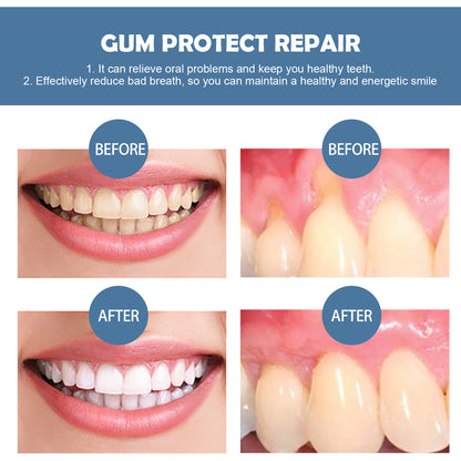 Gum Repair Series Cleaning Tooth Stains