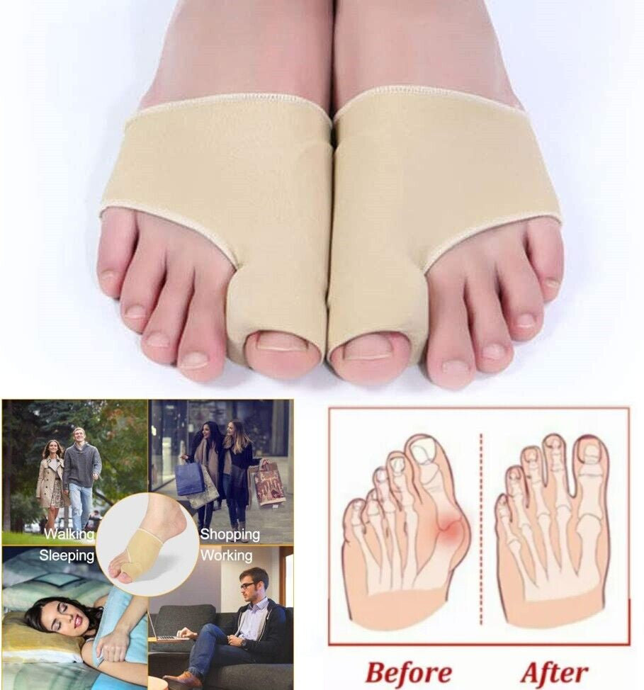 Big Toe Bunion Corrector Splint Straightener Valgus Pain Relief Big Bone