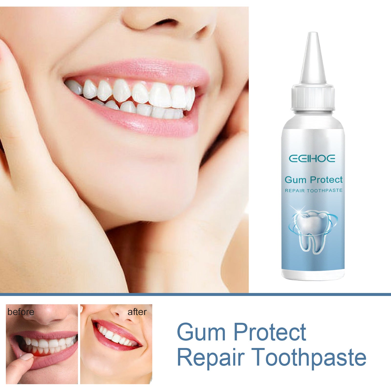 Gum Repair Series Cleaning Tooth Stains