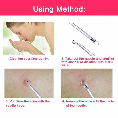 Ear Wax Remover Spoon Earwax Picker and Pimple Blackhead Remover Tools - COMBO KIT